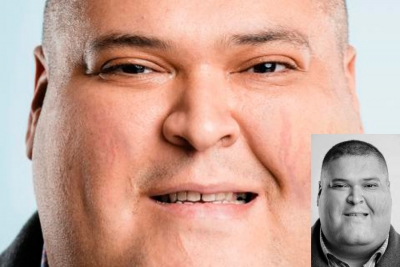 El Síndrome de Cushing